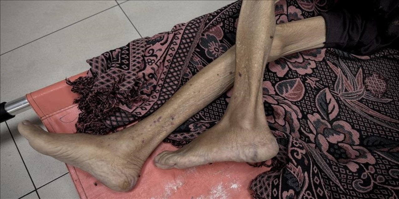 Katil israil: Gazze'de 3'ü çocuk 10 kişi daha açlıktan şehit oldu