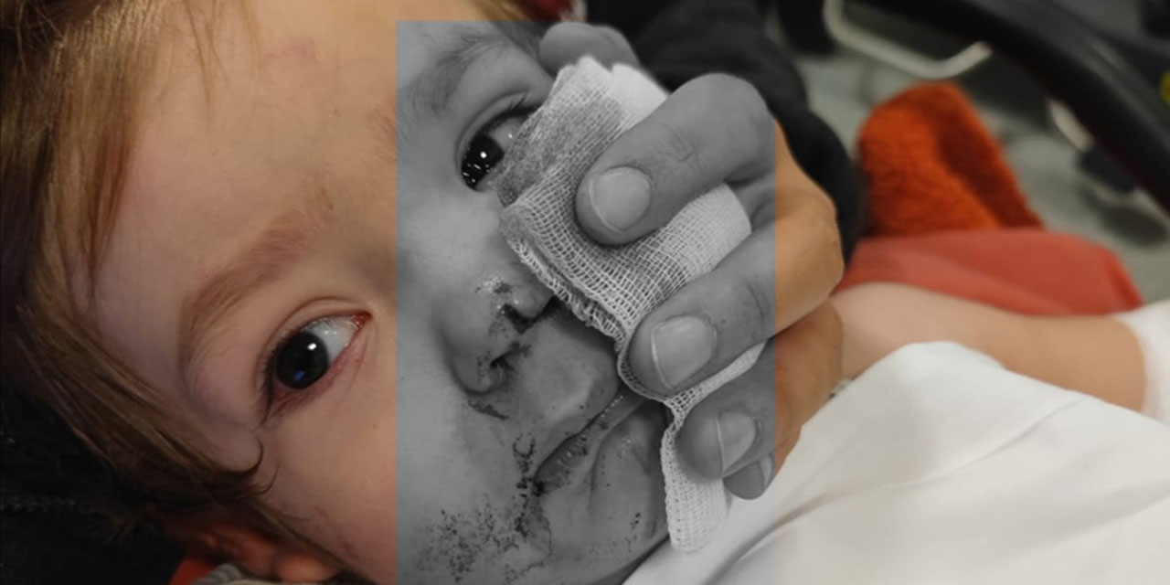 Ankara'da 2 çocuğu yaralayan pitbull köpeğin sahibi tutuklandı: 12 kere şikayet edilmiş!