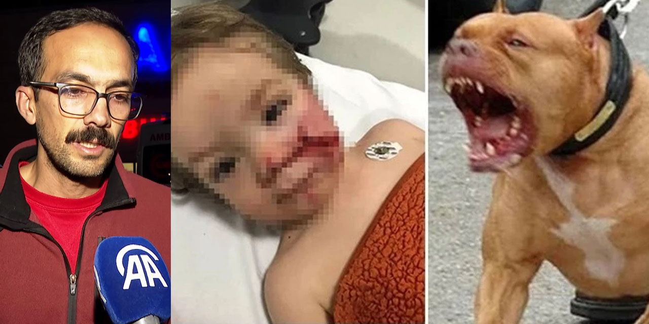 Acılı babanın isyanı: İlla bu köpeğin bir çocuğu öldürmesi mi gerekiyordu?