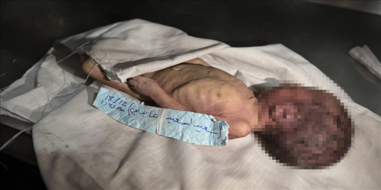 Gazze’de bebekler ve çocuklar donarak ölüyor