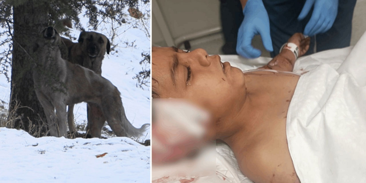 Köpek terörü devam ediyor: Çocuğu paramparça ettiler!