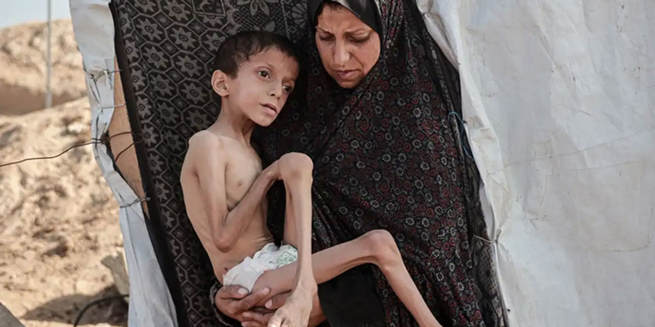 BM: Gazze'de akut yetersiz beslenme vakaları 95 bine dayandı