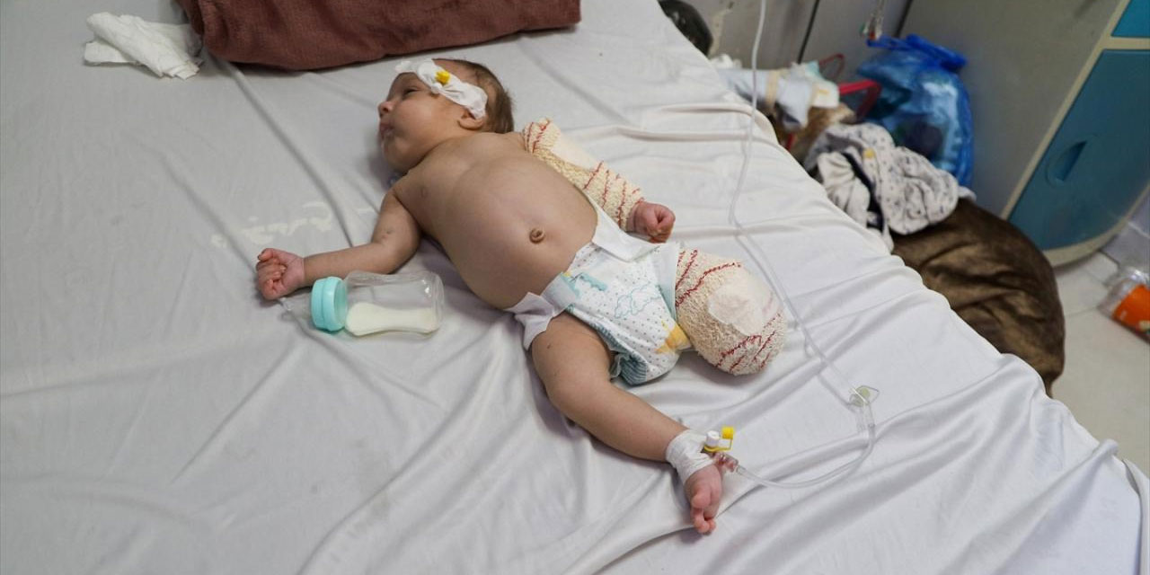 Katil israil: 50 günlük bebek, annesi ve bacağından sonra elini de kaybedebilir