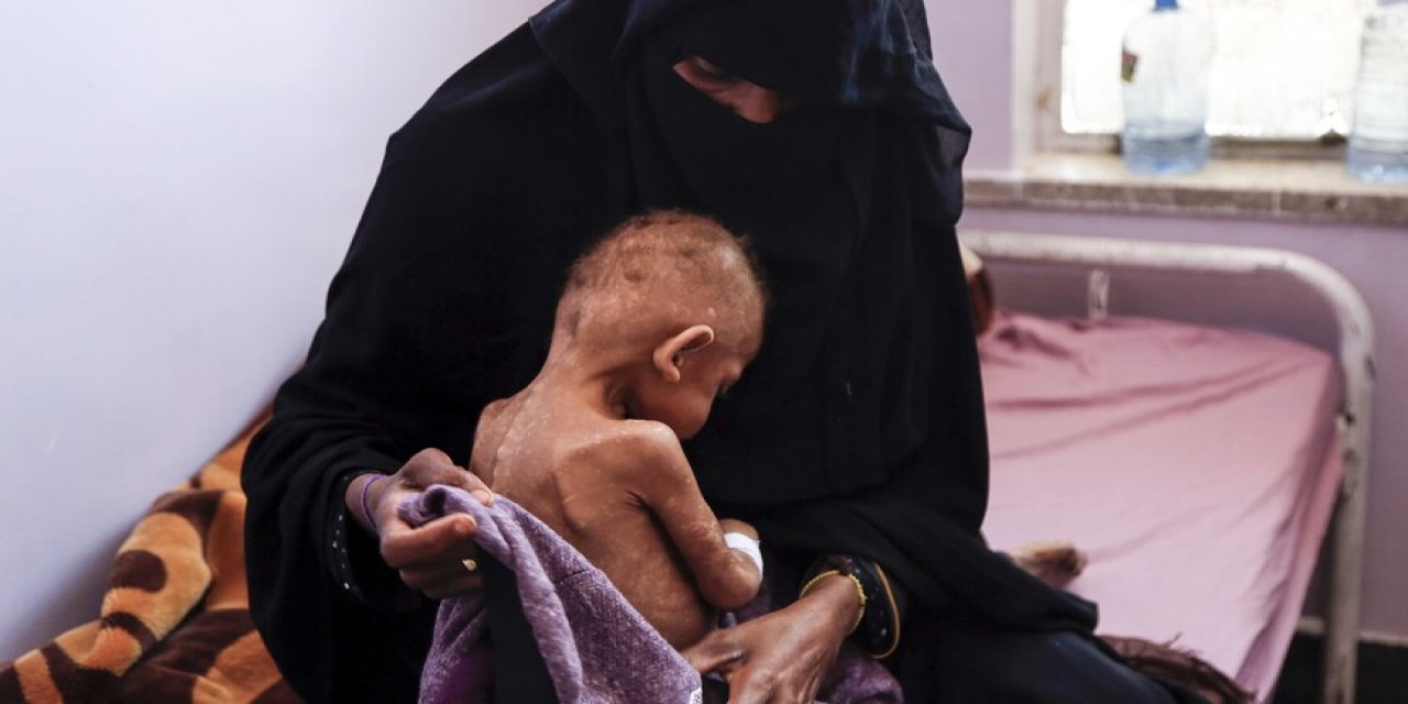 BM: Yemen'de 18 milyondan fazla insan şiddetli açlık içinde