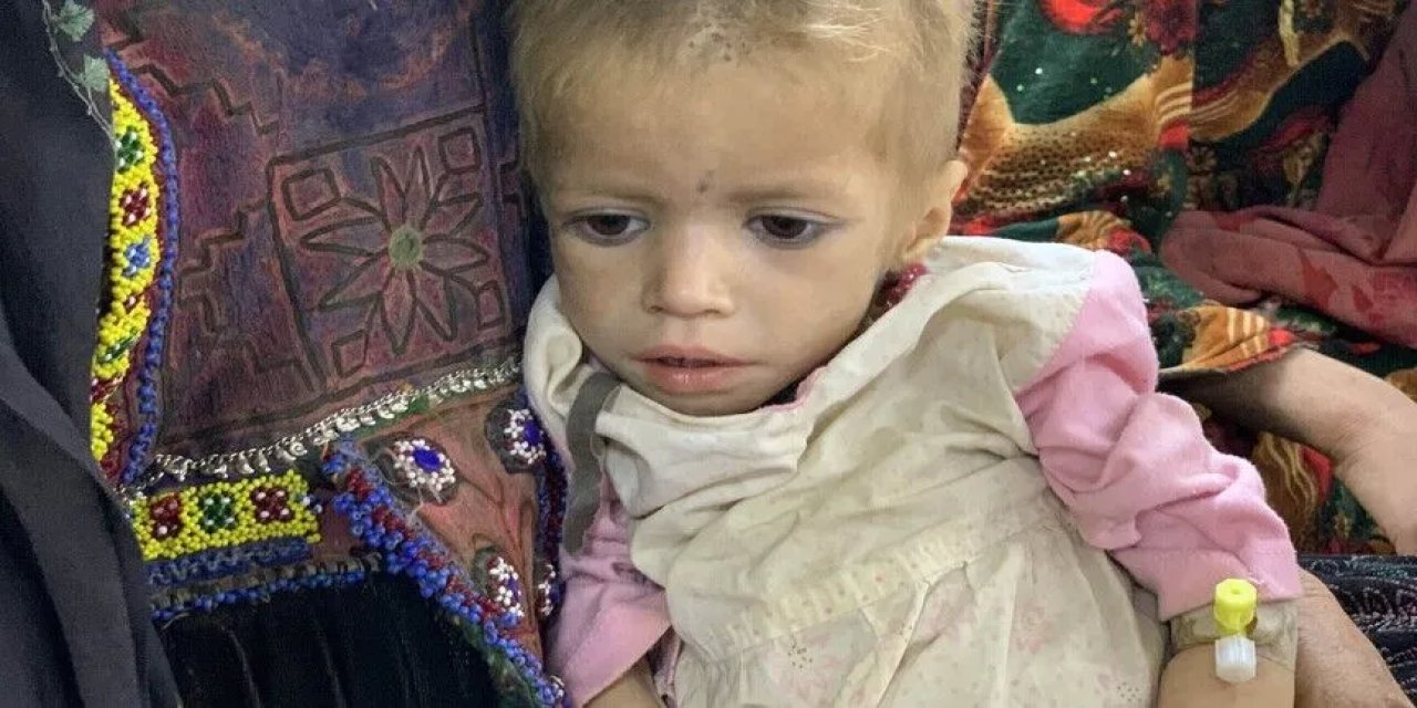UNICEF: Afganistan'da 3,7 milyon çocuk yetersiz beslenme sebebiyle acı çekiyor