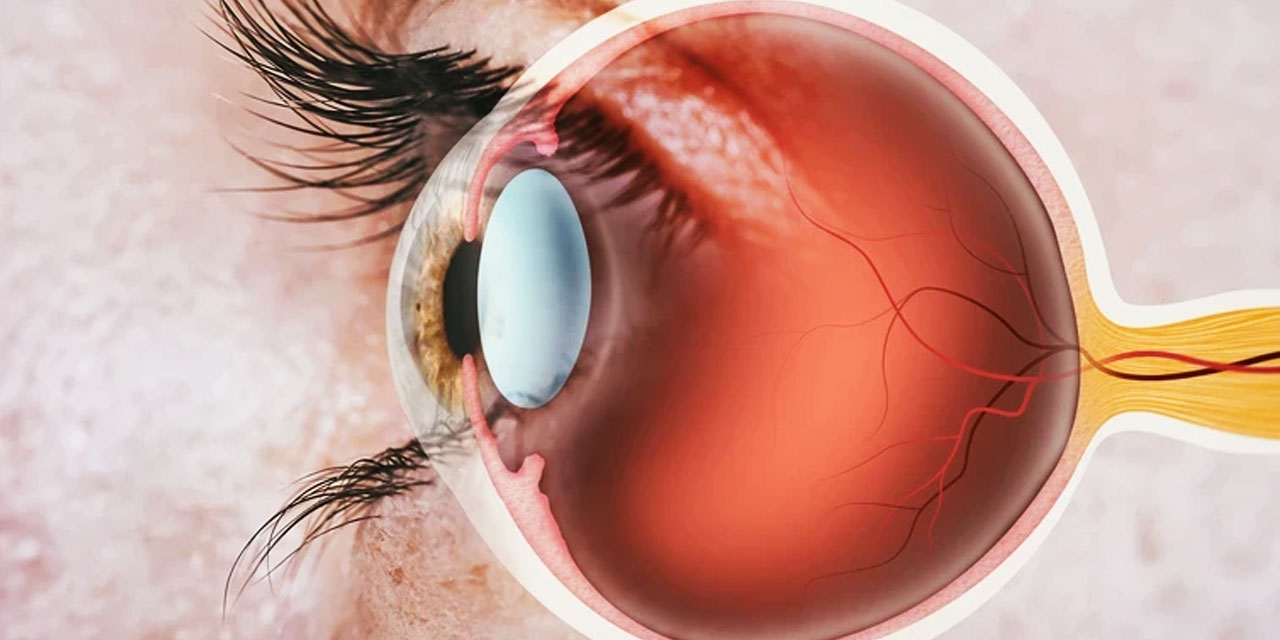 Tıp tarihinde bir ilk! Retinal nakil yapıldı, yıllar sonra yeniden görmeye başladı