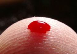 Pankreas kanseri riskini kan grubu belirliyor