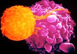 Tuzlu yemek, mide kanseri yapıyor