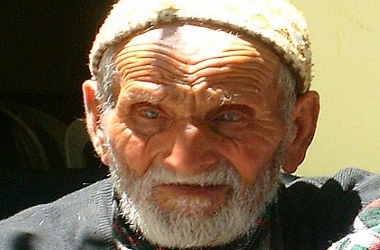 Bu belirtiler sizde de görülüyorsa kemik erimesine daha yatkınsınız