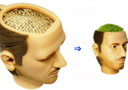 Saç ektireyim derken 'çim adam'a dönmeyin