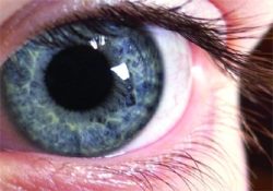 Diyabetliler Ramazanda gözlere dikkat!