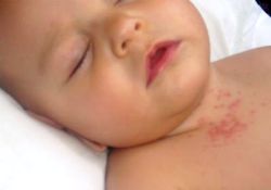 Bulaşıcı kış hastalıkları bebek ve çocukları daha çok etkiliyor