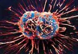 Tümörlü Dokuyu Ayıran Sistem