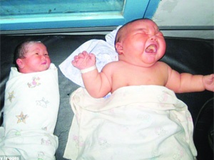 Bebeğiniz çok ağlıyor ve gaz sancısı çekiyorsa süt alerjisi olabilir