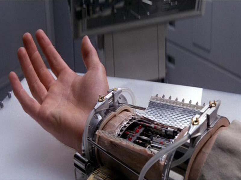 "Hissedebilen" Yapay El