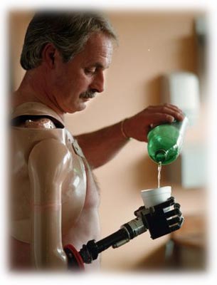 Protezde Yerli Üretim Dönemi