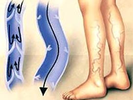 En etkili virüs öldürücü 'Ozon'