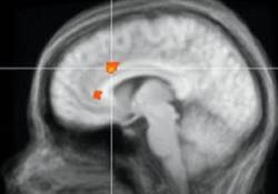 Beyin tümörü tedavisinde sevindirici haber