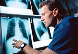 Bilgisayarlı tomografide kanser uyarısı