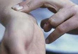 Damar tıkanıklarında Trombolitik tedavi