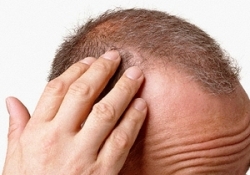 Yanlış diyet yapıp saçınızdan olmayın