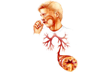 Neden öksürüyoruz?