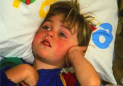 Bir insan hayatı boyunca kaç kez hasta olur?