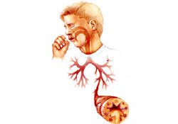 Her öksürük bir hastalığın habercisidir...