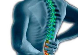 Sizde bel fıtığı var mı?