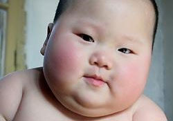 Şişmanlık böbrek taşı riskini artırıyor