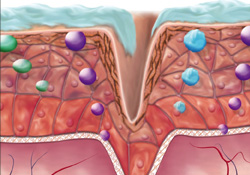 Deri kanserinden korunmak için...