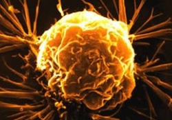 Prostat tedavisi görenler sigaraya dikkat!