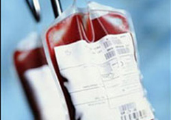 Şifa hücreleri ile saç dökülmesini durdurun