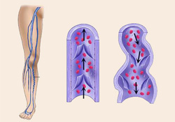 'Varis hastalığı ihmal edilmeye gelmez'