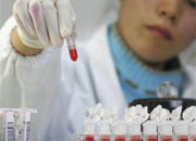 Bu test kanseri oluşmadan belirliyor