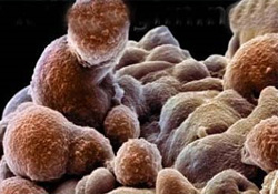 İlk Babalar Günü hediyesi, karaciğeri oldu