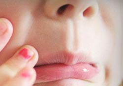 Çocuklar neden tırnak yerler?