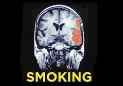 Sigaradaki resmi gören tedavi için bize geliyor