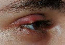 Uzmanlardan arpacık uyarısı