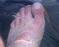 Sedef hastalığının 10 çaresi