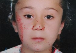 Çevreye atılan mühimmattan 22 yılda 472 çocuk öldü