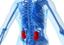 18 bin 250 kişi böbrek bekliyor