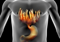 Reflünün tedavi yöntemleri