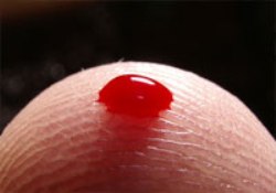 Ciddi bir kanama hastalığı: Hemofili