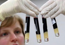 400 milyon kişi kronik Hepatit B