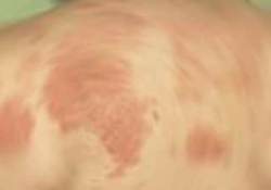 'Sedefte çevresel faktörler büyük önem taşıyor'