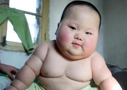 Obezite kanserden ölüm riskini artırıyor