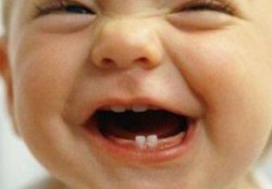 Çocukların dişleri neden çürür?