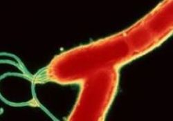 Parkinson'a bir bakteri mi yol açıyor?