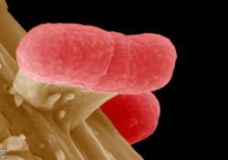 ‘EHEC hamburger aracılığıyla bulaştı’